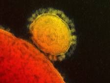 Premier cas de coronavirus MERS aux Etats-Unis