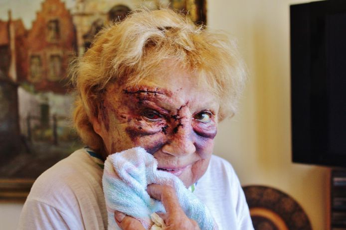 Jacqueline Benoot (78) kreeg klappen met een baseballbat tijdens de brutale overval op zondag 24 juni.