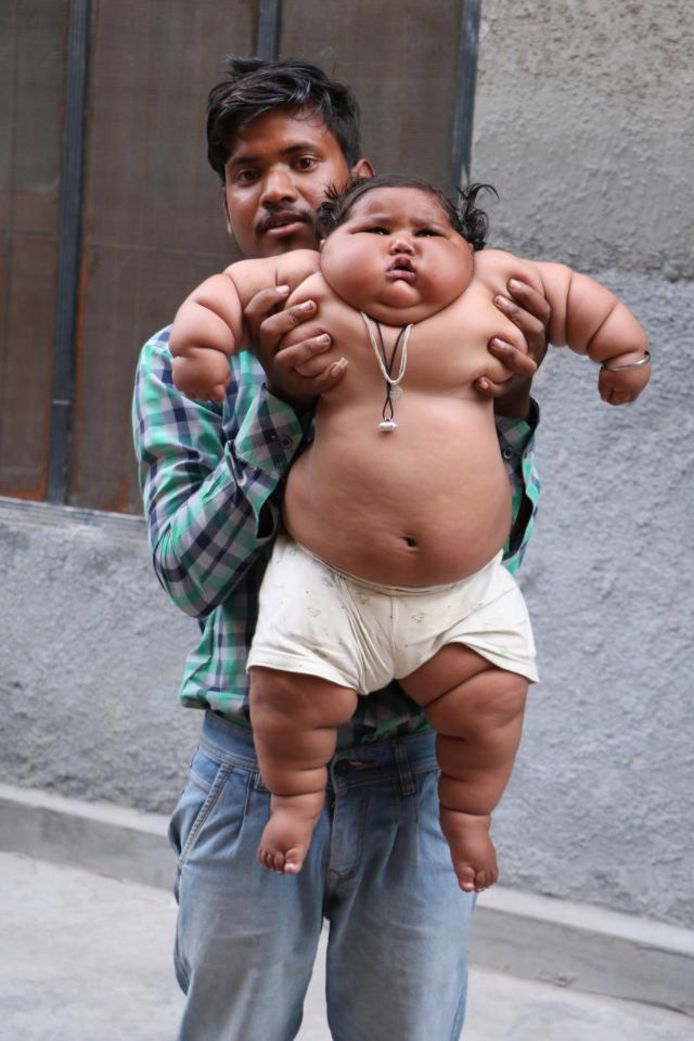 Naar de waarheid leider tweeling Indiase baby van acht maanden weegt zeventien kilo | Bizar | AD.nl