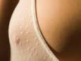 Les seins nus de retour sur Facebook et Instagram?