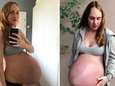 Maria is 34 weken zwanger van drieling en toont foto's van gigantische buik