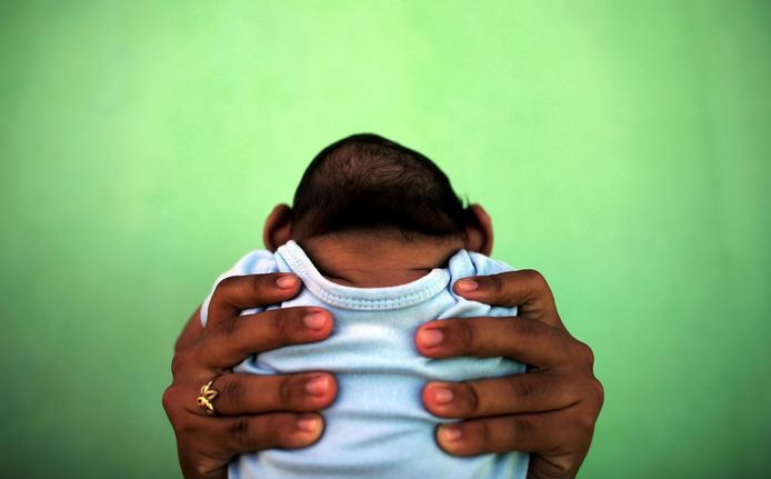 Moeders die tijdens de zwangerschap besmet raken met het zikavirus lopen meer kans om een baby ter wereld te brengen die kampt met microcefalie. Op deze foto toont een vrouw uit Brazilië haar zikababy. Zuid-Amerika kampte in 2015 en 2016 met een ernstige zika-uitbraak.