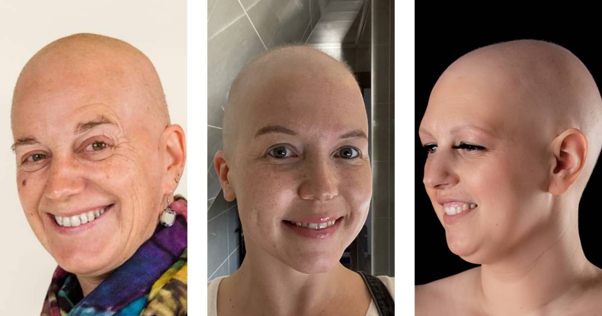 These eight women proudly step out without a wig.  “I don’t want pity.” |  Nina