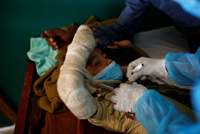 Een jongen  met difterie wordt onderzocht in Bangladesh.