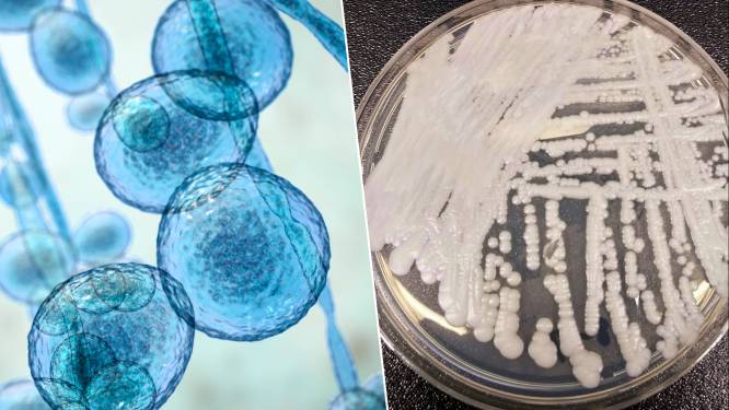 Nederlands gezondheidsinstituut bereidt zich voor op mogelijke uitbraak van ‘candida auris’-schimmel 