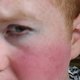 Venetiaans blonde jongeman uit internethit 'Gingers Do Have Souls' ondergaat geslachtstransitie (filmpje)