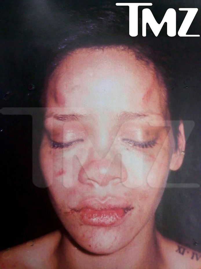 Het beeld dat TMZ in 2009 kon bemachtigen van Rihanna, nadat ze mishandeld werd door haar toenmalige vriend Chris Brown