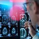 Fabrikanten positief over nieuw medicijn dat alzheimer afremt