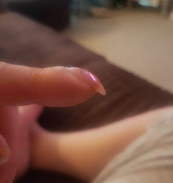 Verwonderlijk Foto van haar gebogen vingernagel op Facebook redt Britse vrouw NS-34