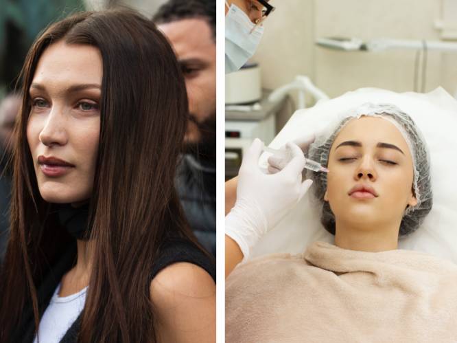 Steeds meer jonge vrouwen willen het ‘Instagramgezicht’. Cosmetisch chirurg: “De ingrepen gaan tegen de natuur in”