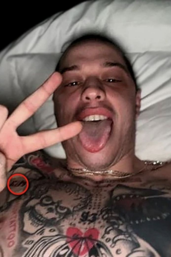 Pete Davidson met zijn brandmerk.