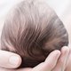 Bijzondere babyfoto: 4 jaar, 3 miskramen en 1.161 injectienaalden verder...