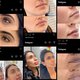 ‘Cosmetische ingrepen worden steeds ‘normaler’ en dat is zorgwekkend. Het blijven medische ingrepen, en die zijn niet zonder risico’