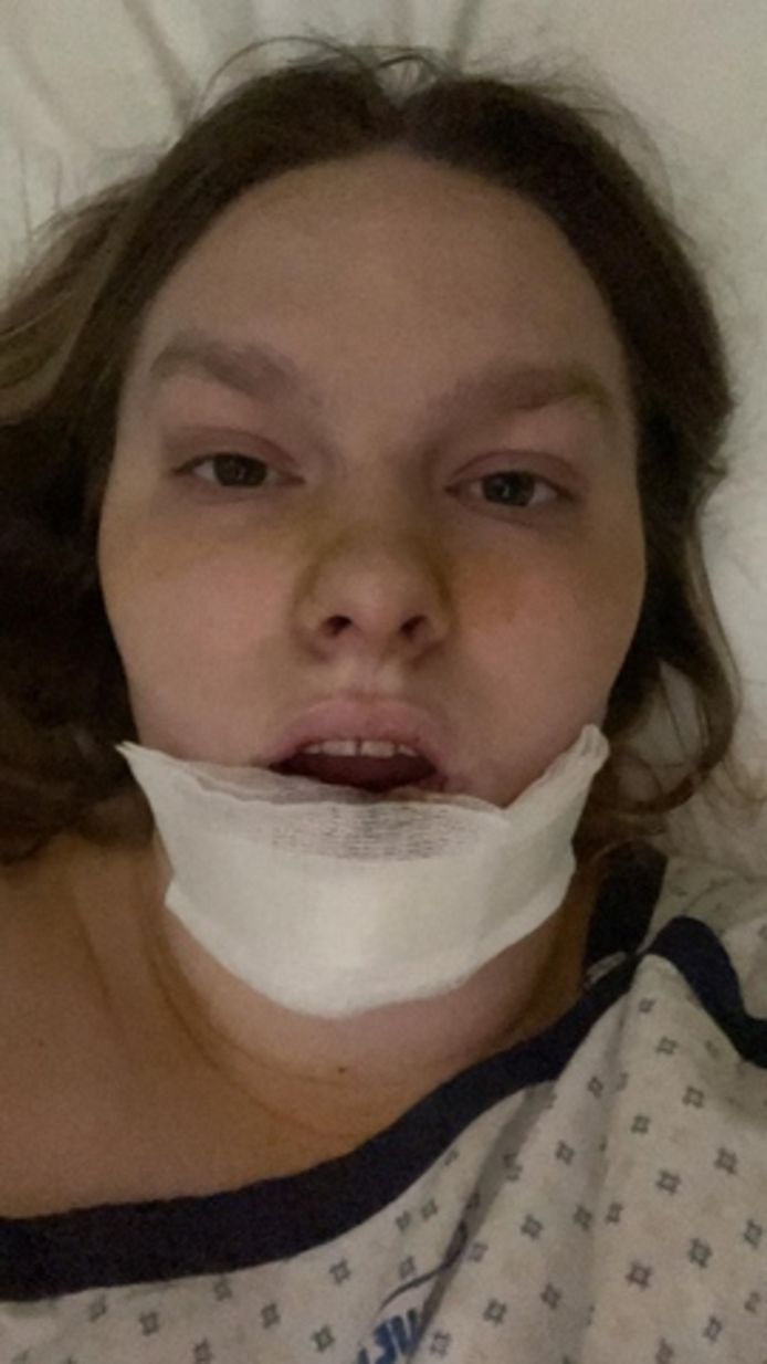Lejla haar onderlip werd door de aanval volledig afgebeten. Ondertussen heeft ze een aantal operaties ondergaan om haar lip te laten herstellen.
