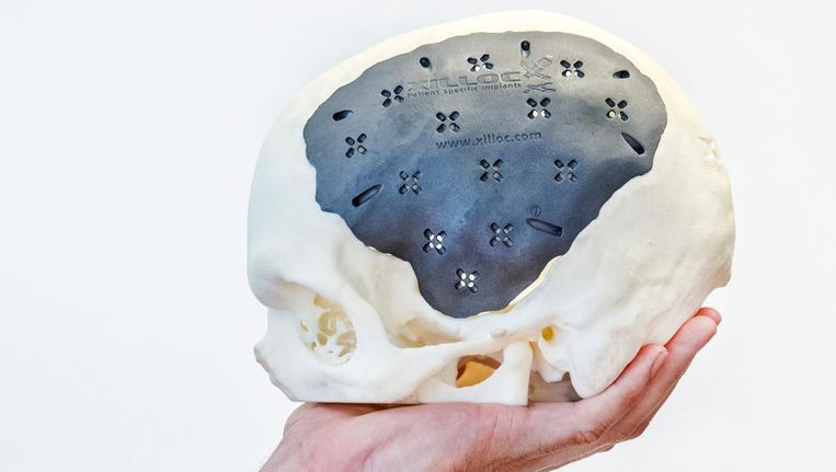 Een door Xilloc gemaakte schedel. Beeld Raymond Rutting/de Volkskrant