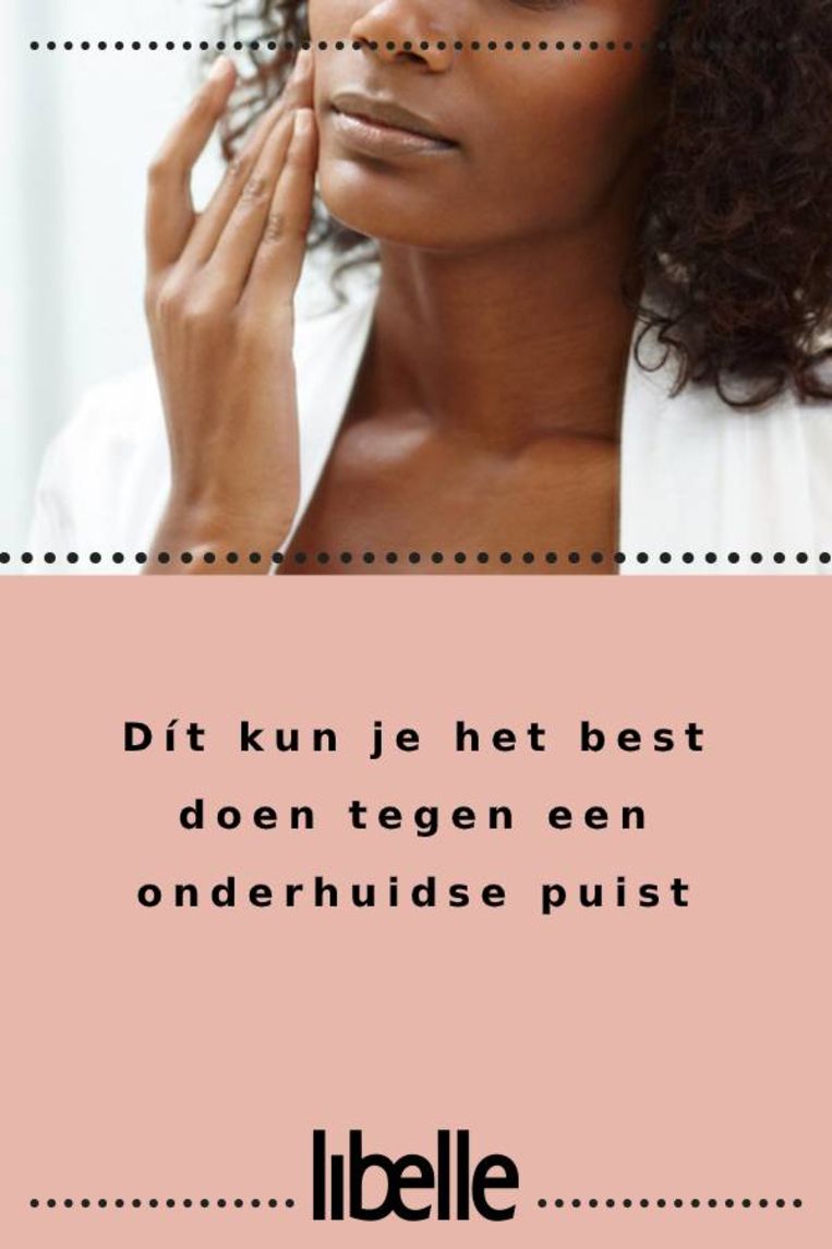 Dít kun je het best doen tegen een onderhuidse puist Libelle