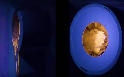 ‘Gebruik geen handdrogers meer in het ziekenhuis’