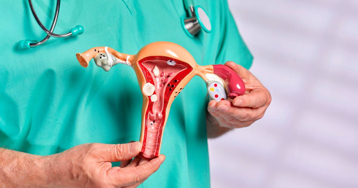 I tassi di sopravvivenza al cancro ovarico sono più elevati per le pazienti trattate nei centri di riferimento |  medico