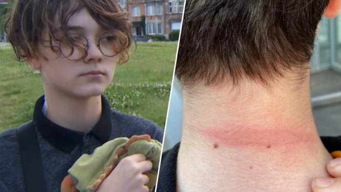 Trans jongen Luca (13) aangevallen na Pride Brussel: “Hij houdt er een brandwonde, blauwe plekken en nachtmerries aan over”