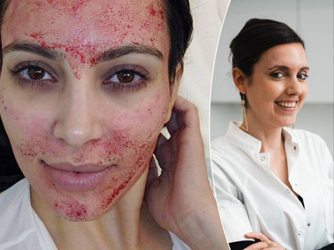 “Efficiënt tegen huidveroudering, acne én vroegtijdig kaal worden”: dermatoloog geeft uitleg over PRP-therapie, de 'vampire facelift’