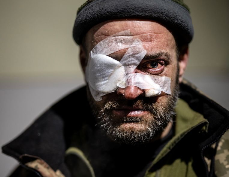 Pavlo, een Oekraïense soldaat die door een raketgranaat aan zijn oog verwond is. Beeld NYT