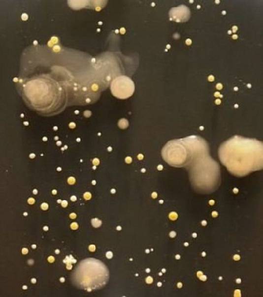 Si certaines bactéries sont inoffensives, d'autres contiennent des germes de staphylocoque doré.
