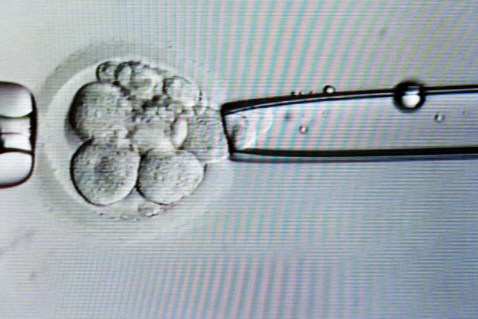 Foto ter illustratie: biopsie van een cel uit een embryo voor ivf.