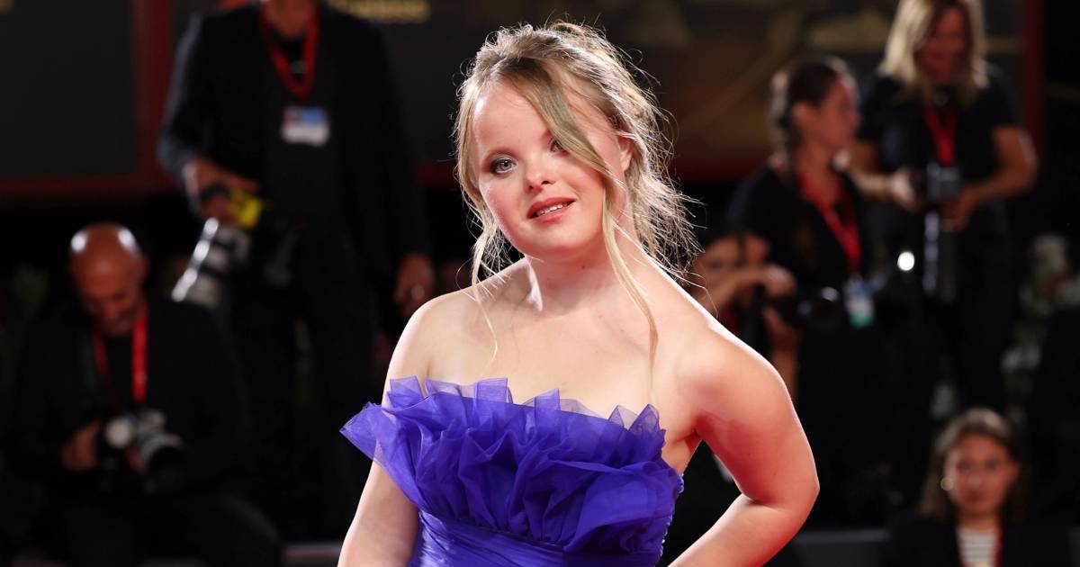 A model with Down Syndrome shines at London Fashion Week: “I want to change the world of fashion” |  Instagram HLN