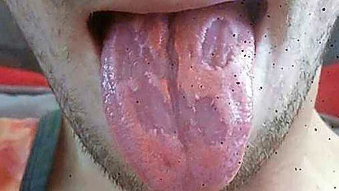 Een leraar schrijft in een Facebookbericht dat zijn "tong weggevreten is door zijn verslaving aan energiedrank".