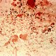 Zijn 'immunobiotica' het antwoord op resistente bacteriën?