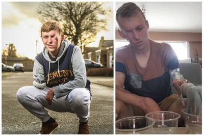 Joeri (25) raakte zwaar verminkt bij dodehoekongeval met vrachtwagen, nu toont hij wat hij kan met zijn bionische prothese