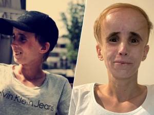 “Ze is echt door het oog van de naald gekropen”: Charlotte (32) belandde door gebrek aan medicatie in kunstmatige coma