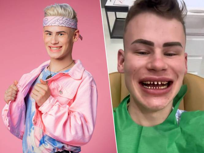 Ziggy uit 'K2 zoekt K3' reisde af naar Turkije voor een nieuw gebit: “Ik heb er bijna 10.000 euro voor betaald”