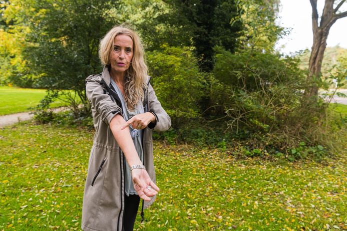 Katinka Heres heeft overal jeuk als gevolg van een vijftigtal wespensteken.
