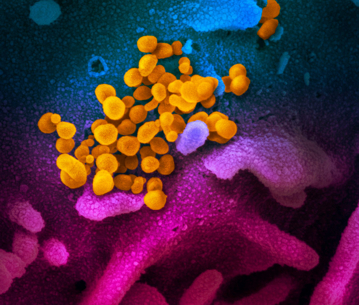 Een microscopisch beeld van het COVID-19-virus (geel).