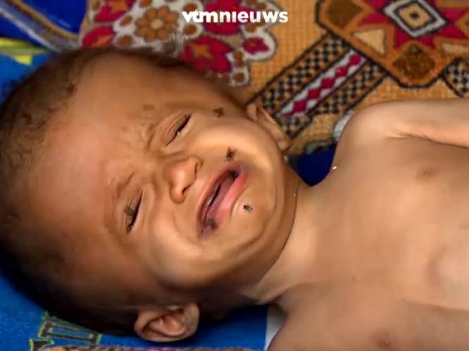 VIDEO. De honger in Jemen krijgt een gezicht