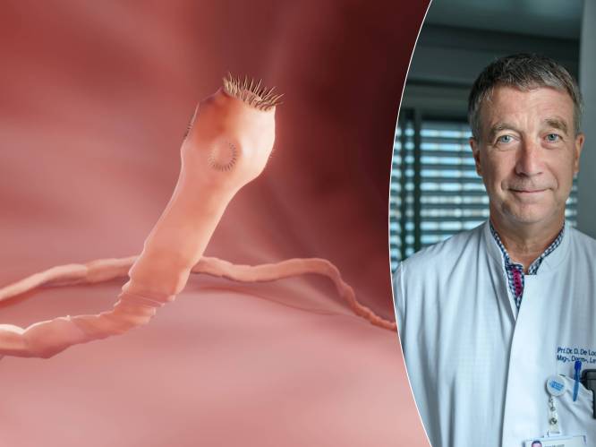Heb je last van vage buikpijn en krampen? Misschien is het wel een lintworm: “Ze kunnen tot 10 meter lang worden”