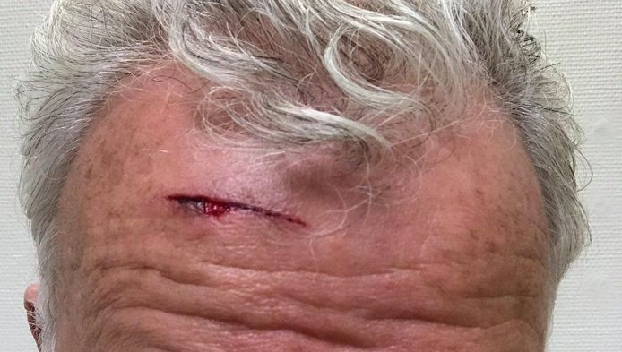 Peter R. de Vries loopt tegen vliegtuig op: snee in hoofd ...
