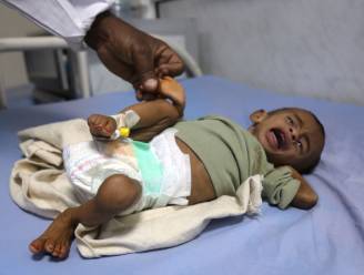 "’s Werelds ergste humanitaire crisis": 5 kinderen per dag raken gewond of sterven in Jemen