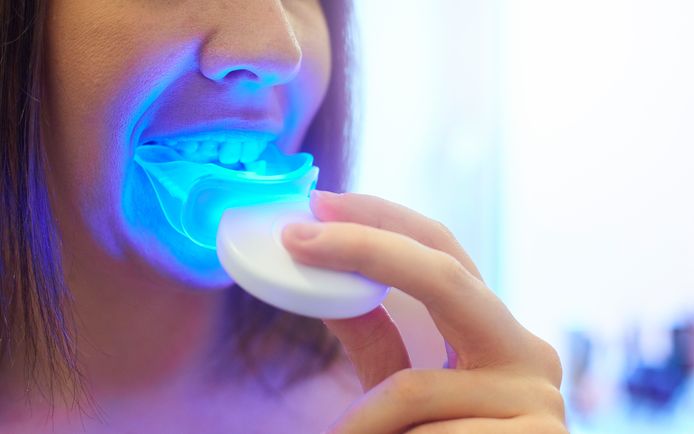 De gel in het bitje, op basis van een werkzame concentratie waterstofperoxide, maakt de tanden elke dag een beetje lichter