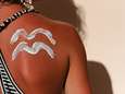 SOS coup de soleil: que faire pour soulager votre peau
