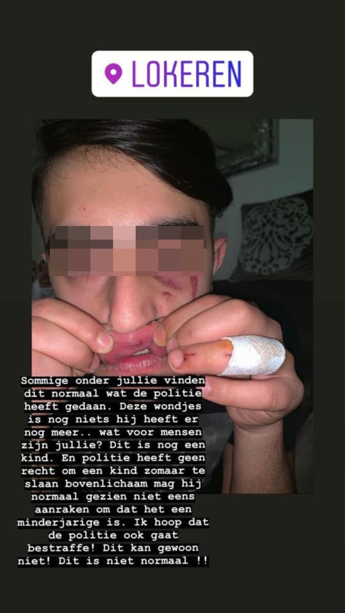 Eén van de gearresteerde jongeren postte nadien foto's van zijn verwondingen op sociale media.