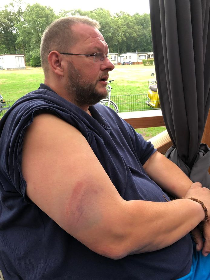 Freddy Eikelboom toont de bloeduitstorting op zijn arm die volgens hem het gevolg is van onnodig politie-optreden na Vitesse - PEC Zwolle.