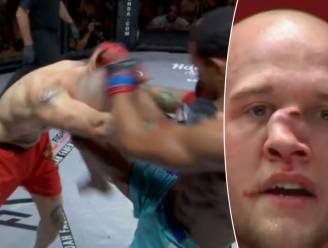 MMA-vechter loopt na kniestoot in het gezicht een verschrikkelijk gebroken neus op