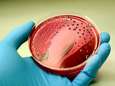 Wetenschappers UAntwerpen ontdekken: “Dodelijke salmonellavarianten amper te behandelen met antibiotica”