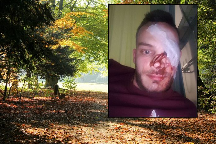 Foto's van het slachtoffer van een zware mishandeling leidden uiteindelijk naar de dader. Het linkeroog is uiteindelijk verloren gegaan. Op de achtergrond het Philips de Jonghpark in Eindhoven waar het tijdens een festival gebeurde