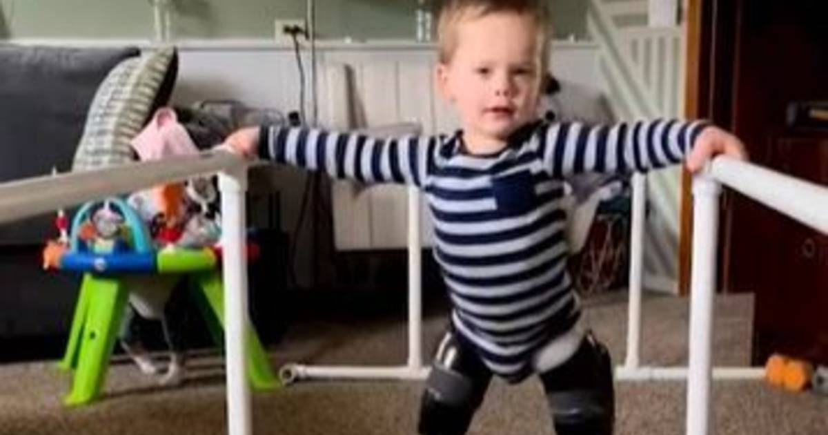 After the double amputation, Louie (2) runs like a “blade runner” just as fast as other young children |  Abroad