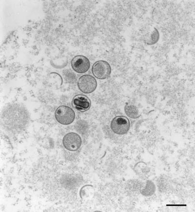 Dix pays européens, dont la Belgique, lancent une étude pour mieux connaître la variole du singe