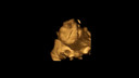 Foetus trekt een vies gezicht, nadat de moeder boerenkool heeft gegeten.