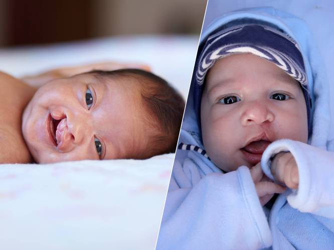 300 baby’s per jaar worden geboren met schisis: ‘Sommige patiënten blijven een afwijkende spraak houden’